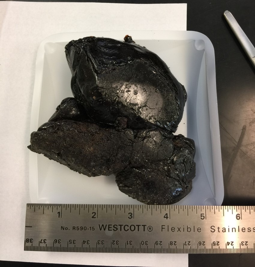black tar heroin